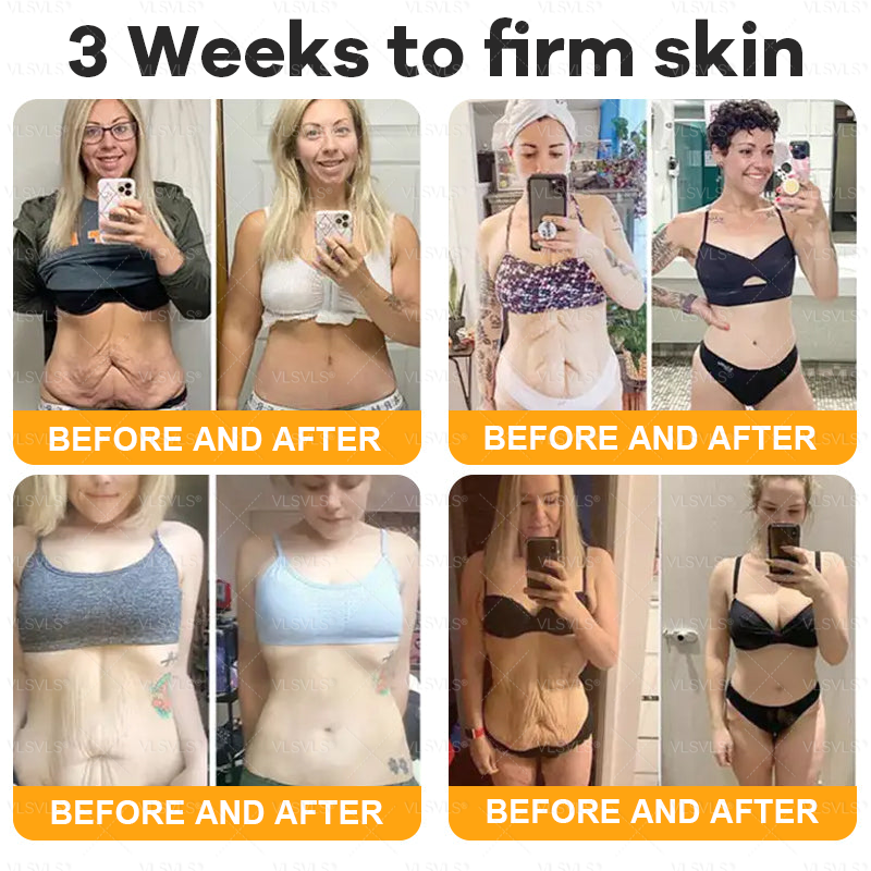 VLSVLS® Bee Venom Comprehensive Cream ✨LAST DAY 80% OFF (Sagging Skin, Fine Lines, Loss of Firmness, Flat Bust, Drooping Hips, and More)