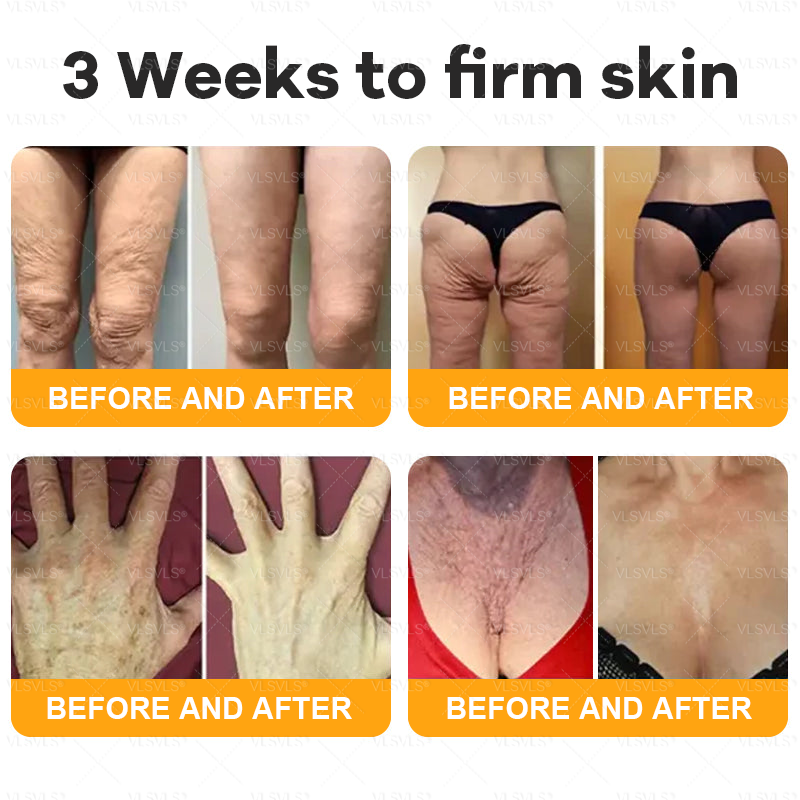 VLSVLS® Bee Venom Comprehensive Cream ✨LAST DAY 80% OFF (Sagging Skin, Fine Lines, Loss of Firmness, Flat Bust, Drooping Hips, and More)