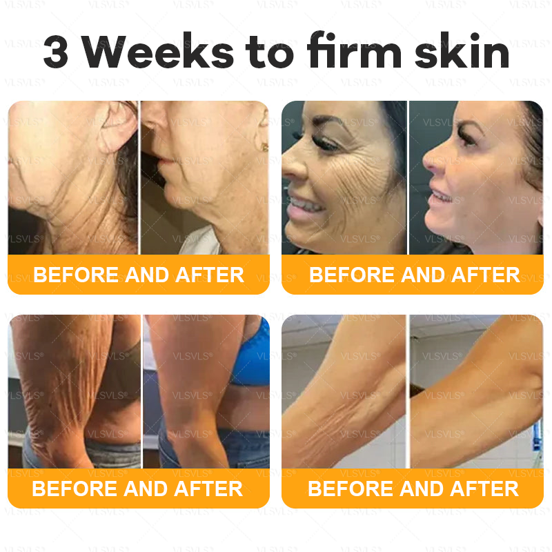 VLSVLS® Bee Venom Comprehensive Cream ✨LAST DAY 80% OFF (Sagging Skin, Fine Lines, Loss of Firmness, Flat Bust, Drooping Hips, and More)
