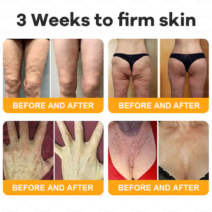 VLSVLS® Bee Venom Comprehensive Cream  ✨LAST DAY 80% OFF (Sagging Skin, Fine Lines, Loss of Firmness, Flat Bust, Drooping Hips, and More)